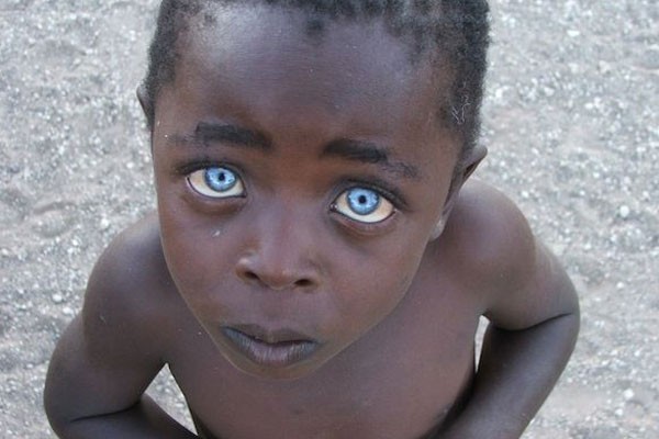 Amazing blue eyes