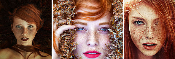 Freckled People Who’ll Hypnotize You With Their Unique Beauty