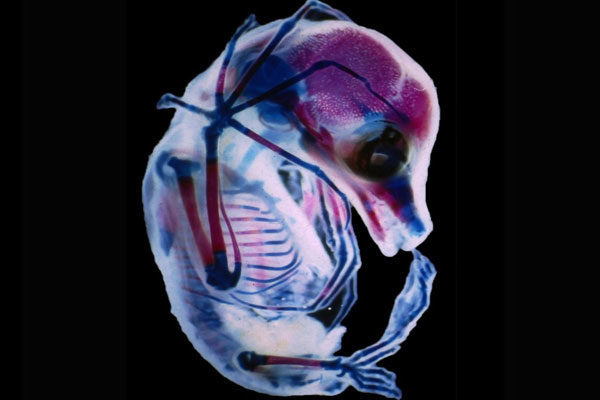 Megachiroptera’s fetus, Colorado